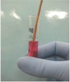 Mycoplasma culture. Swabs should be gently swirled in mycoplasma broth media and discarded. (Do not leave swabs in the media; do not pool samples).
