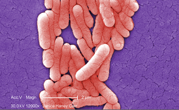 The link between Salmonella and intestinal health