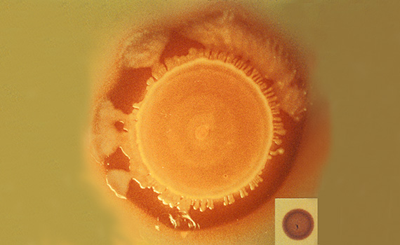 Salmonella Petri Dish Cropped