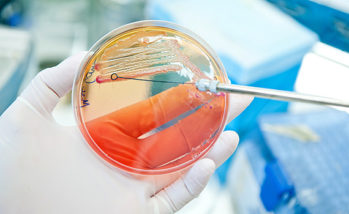 Modified-live E. coli vaccine reduces E. coli population