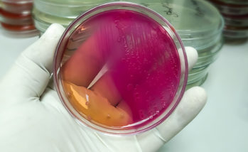E. coli implicated in layer gut disease